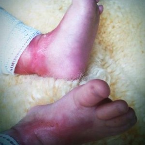Liam's Feet