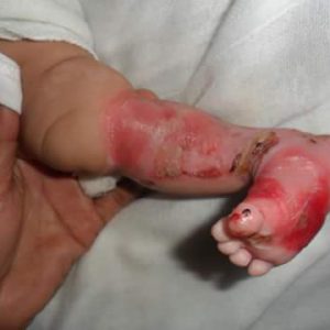 Shamila Jayne's Leg